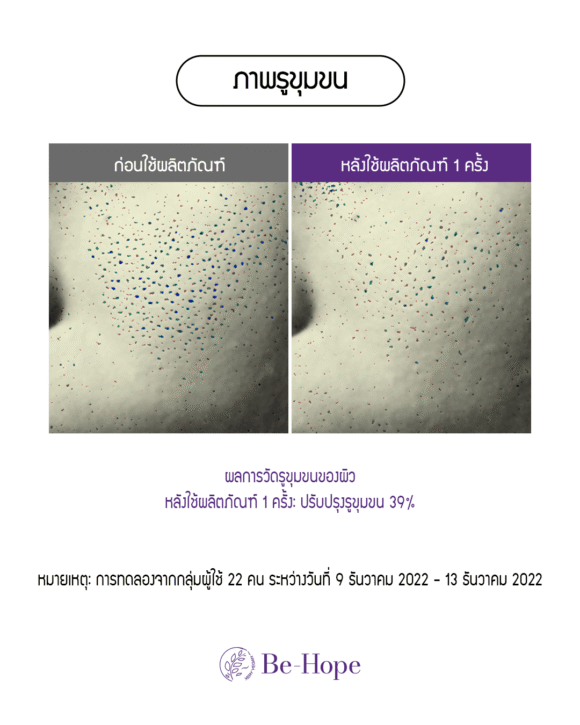 Be-Hope Vegan Pore Lifting Roller Cream — ครีมยกกระชับรูขุมขนและผิวหน้า - Image 4